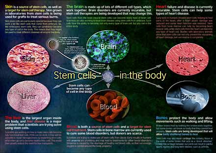 The introductory stem cell poster, accompanying Troy